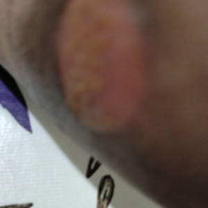 A los 7 días 16/04 primer aplicación